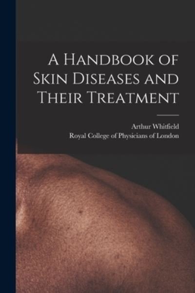 A Handbook of Skin Diseases and Their Treatment - Arthur 1868- Whitfield - Books - Legare Street Press - 9781014891716 - September 9, 2021