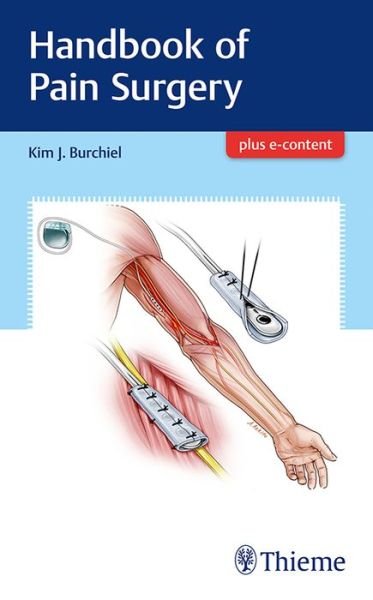 Handbook of Pain Surgery - Kim Burchiel - Books - Thieme Medical Publishers Inc - 9781626238718 - October 25, 2017