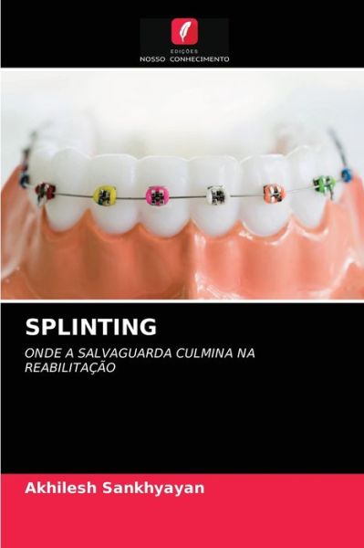 Splinting - Akhilesh Sankhyayan - Books - Edicoes Nosso Conhecimento - 9786203698718 - May 14, 2021