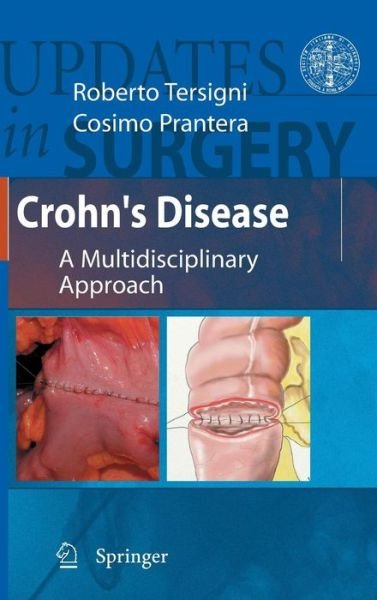 Roberto Tersigni · Crohn's Disease: A Multidisciplinary Approach - Updates in Surgery (Hardcover Book) [2010 edition] (2009)