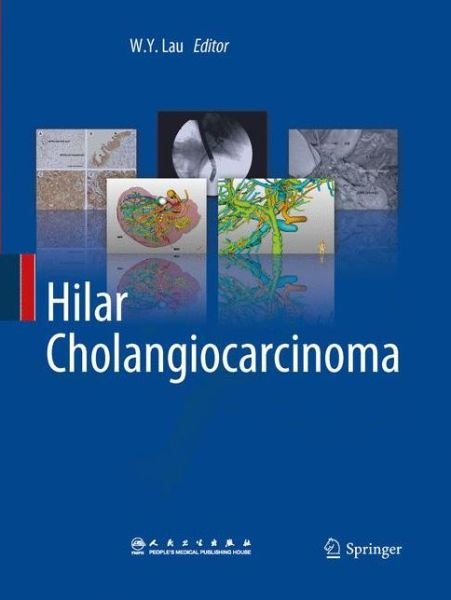 Cover for W Y Lau · Hilar Cholangiocarcinoma (Paperback Book) [2013 edition] (2015)