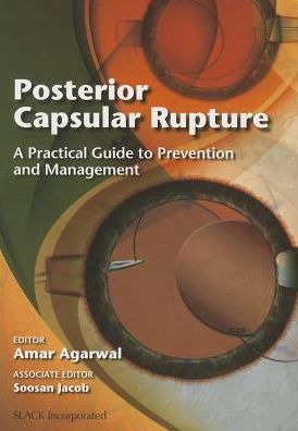 Cover for Amar Agarwal · Posterior Capsular Rupture: A Practical Guide to Prevention and Management (Paperback Book) (2013)