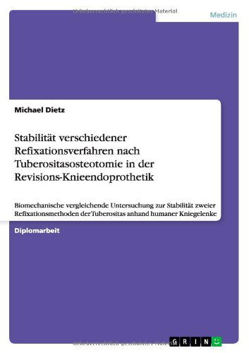 Cover for Dietz · Stabilität verschiedener Refixati (Book) [German edition] (2011)