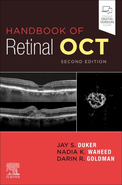 Cover for Duker, Jay S., MD (Director, New England Eye Center, Chairman and Professor of Ophthalmology, Tufts Medical Center, Tufts University School of Medicine, Boston, Massachusetts) · Handbook of Retinal OCT: Optical Coherence Tomography (Taschenbuch) (2021)