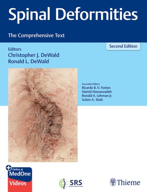 Cover for Christopher DeWald · Spinal Deformities: The Comprehensive Text (Inbunden Bok) (2024)