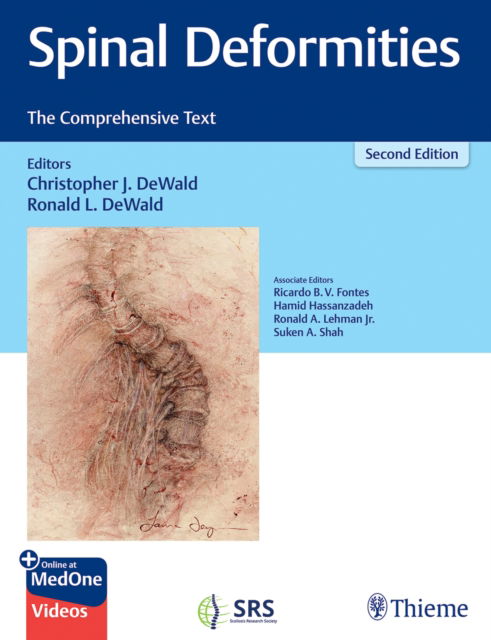 Cover for Christopher DeWald · Spinal Deformities: The Comprehensive Text (Hardcover Book) (2024)