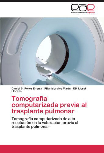 Cover for Rm Lloret Llorens · Tomografía Computarizada Previa Al Trasplante Pulmonar: Tomografía Computarizada De Alta Resolución en La Valoración Previa Al Trasplante Pulmonar (Taschenbuch) [Spanish edition] (2012)