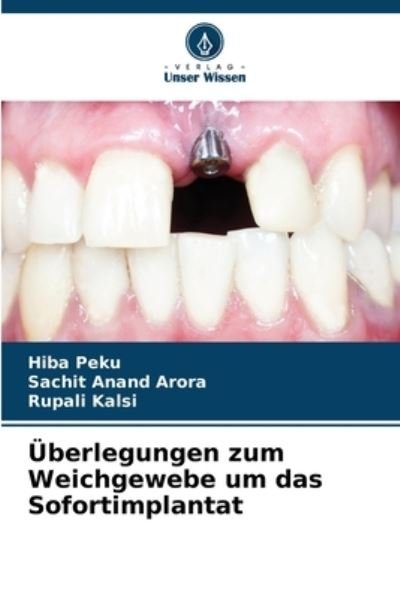 Cover for Hiba Peku · UEberlegungen zum Weichgewebe um das Sofortimplantat (Pocketbok) (2022)