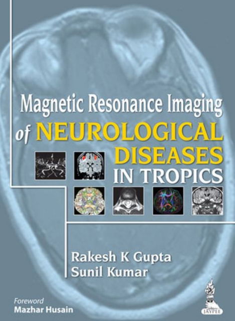 Cover for Rakesh K. Gupta · Magnetic Resonance Imaging of Neurological Diseases in Tropics (Hardcover Book) (2014)