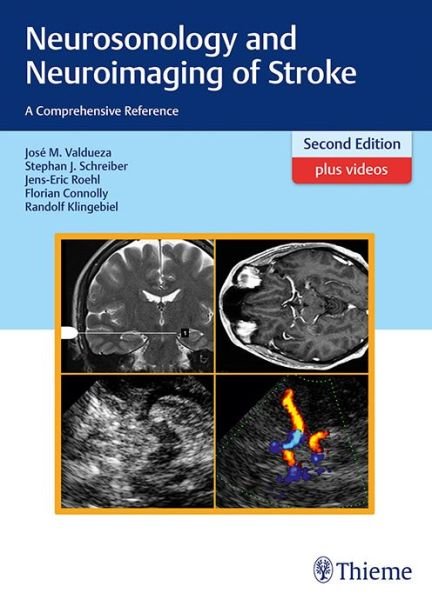 Cover for Jose Manuel Valdueza · Neurosonology and Neuroimaging of Stroke: A Comprehensive Reference (Inbunden Bok) (2016)