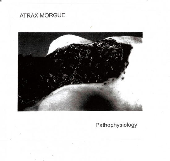 Cover for Atrax Morgue · Pathophysiology (CD) [Digipak] (2019)