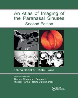 Cover for Lalitha Shankar · Atlas of Imaging of the Paranasal Sinuses, Second Edition (Paperback Book) (2019)