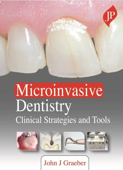 Cover for John J Graeber · Microinvasive Dentistry: Clinical Strategies and Tools (Innbunden bok) (2020)