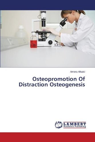 Cover for Alkaisi Amera · Osteopromotion of Distraction Osteogenesis (Pocketbok) (2013)