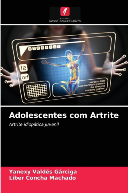 Cover for Yanexy Valdes Garciga · Adolescentes com Artrite (Paperback Book) (2021)