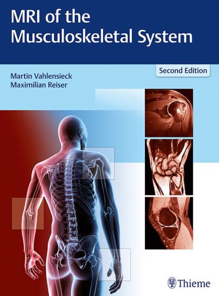 Cover for Vahlensieck Martin · MRI of the Musculoskeletal System (Hardcover Book) (2017)