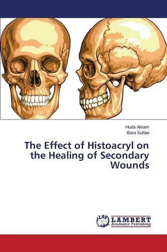 Cover for Sultan Bara · The Effect of Histoacryl on the Healing of Secondary Wounds (Paperback Book) (2014)