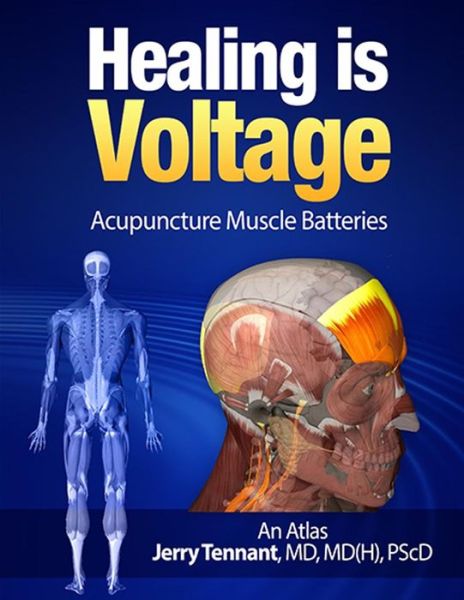 Cover for Md Jerry L Tennant Md · Healing is Voltage: Acupuncture Muscle Batteries (Paperback Book) (2015)