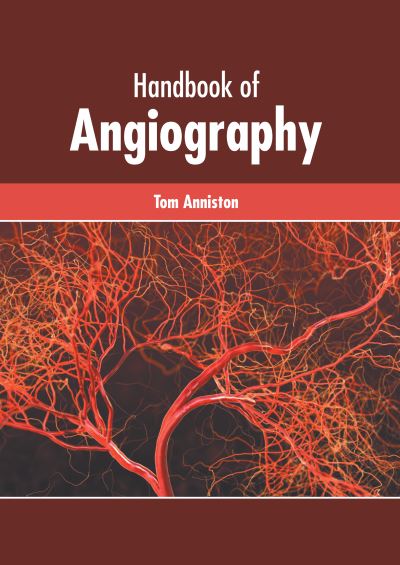 Cover for Tom Anniston · Handbook of Angiography (Hardcover Book) (2022)