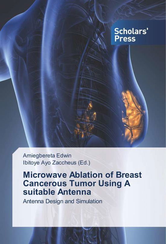 Cover for Edwin · Microwave Ablation of Breast Canc (Buch)