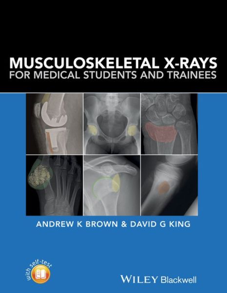 Cover for Brown, Andrew K. (Consultant Rheumatologist and Senior Lecturer in Medical Education, Hull York Medical School) · Musculoskeletal X-Rays for Medical Students and Trainees (Paperback Book) (2016)