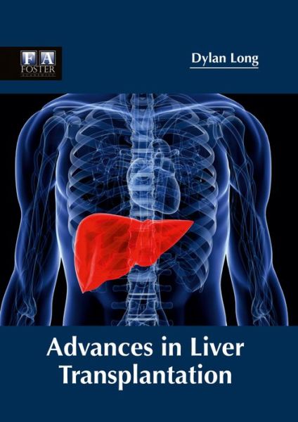 Cover for Dylan Long · Advances in Liver Transplantation (Inbunden Bok) (2017)