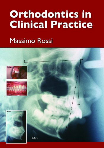 Cover for Massimo Rossi · Orthodontics in Clinical Practice (Hardcover Book) (2015)