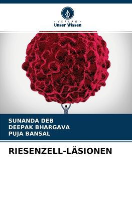 Cover for Sunanda Deb · Riesenzell-Lasionen (Paperback Bog) (2021)