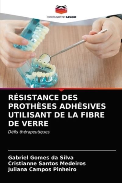 Cover for Gabriel Gomes Da Silva · Resistance Des Protheses Adhesives Utilisant de la Fibre de Verre (Paperback Book) (2021)