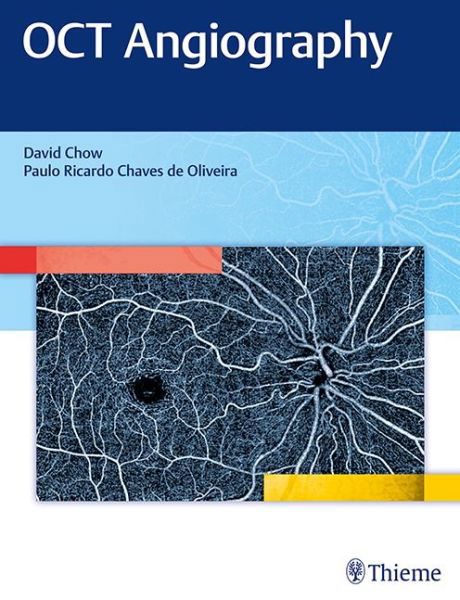 OCT Angiography - David Chow - Books - Thieme Medical Publishers Inc - 9781626234734 - November 15, 2017