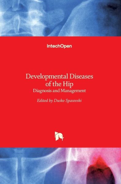 Cover for Dusko Spasovski · Developmental Diseases of the Hip: Diagnosis and Management (Hardcover Book) (2017)
