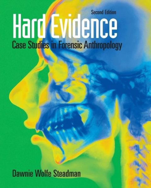 Cover for Dawnie W. Steadman · Hard Evidence: Case Studies in Forensic Anthropology (Paperback Book) (2008)