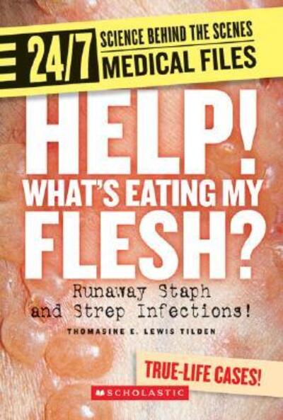 Cover for Thomasine E. Lewis Tilden · Help! What's Eating My Flesh?: Runaway Staph and Strep Infections! (24/7: Science Behind the Scenes) (Hardcover Book) [1st edition] (2007)