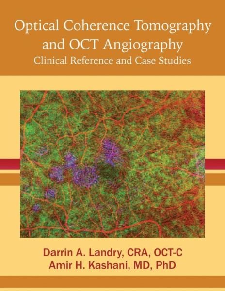Cover for Cra Oct Landry · Optical Coherence Tomography and OCT Angiography (Paperback Bog) (2017)