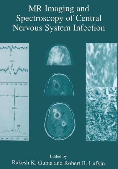 Cover for Rakesh K Gupta · MR Imaging and Spectroscopy of Central Nervous System Infection (Paperback Book) [Softcover reprint of the original 1st ed. 2001 edition] (2012)