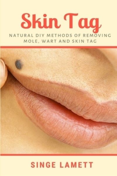 Cover for Singe Lamett · Skin Tag: Natural DIY Methods of removing Mole, Wart and Skin Tag (Paperback Book) (2019)