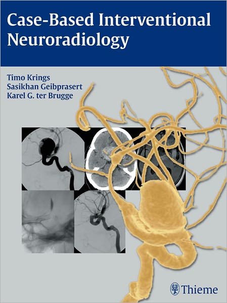 Case-Based Interventional Neuroradiology - Timo Krings - Bøger - Thieme Medical Publishers Inc - 9781604063738 - 4. januar 2011