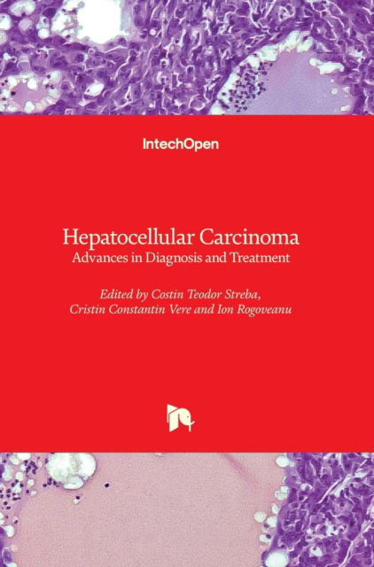 Cover for Costin Teodor Streba · Hepatocellular Carcinoma (Hardcover Book) (2018)