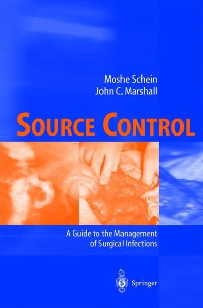 Cover for Moshe Schein · Source Control: A Guide to the Management of Surgical Infections (Taschenbuch) [2003 edition] (2002)