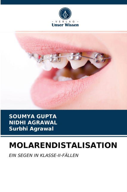 Cover for Soumya Gupta · Molarendistalisation (Paperback Book) (2021)