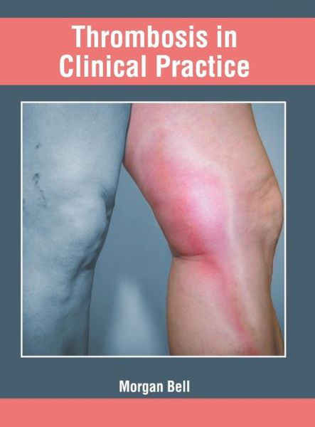 Cover for Morgan Bell · Thrombosis in Clinical Practice (Hardcover Book) (2019)