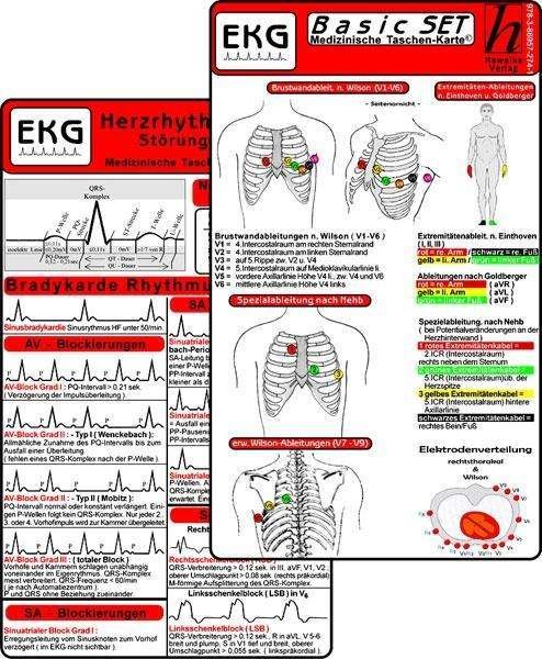 Cover for Ekg Basic Set · EKG Basic Set - Herzrhythmusstörungen, (Book)