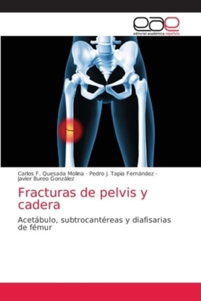 Cover for Carlos F Quesada Molina · Fracturas de pelvis y cadera (Paperback Book) (2021)