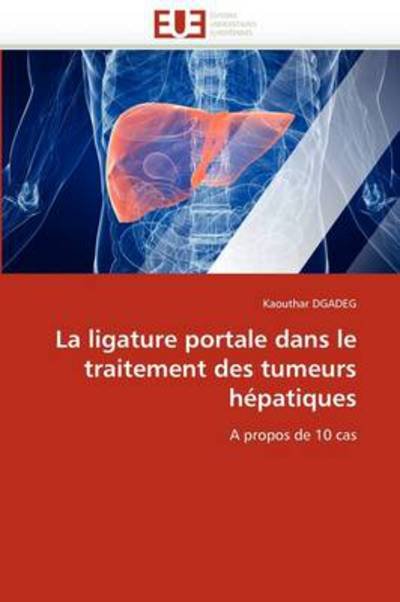 Cover for Kaouthar Dgadeg · La Ligature Portale Dans Le Traitement Des Tumeurs Hépatiques: a Propos De 10 Cas (Pocketbok) [French edition] (2018)