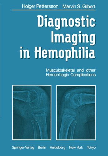 Cover for H. Pettersson · Diagnostic Imaging in Hemophilia: Musculoskeletal and Other Hemorrhagic Complications (Paperback Book) [Softcover reprint of the original 1st ed. 1985 edition] (2011)