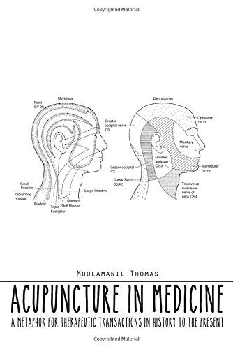 Cover for Moolamanil Thomas · Acupuncture in Medicine: a Metaphor for Therapeutic Transactions in History to the Present (Paperback Book) (2014)