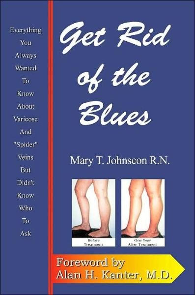 Cover for Mary Johnson · Get Rid of the Blues: Everything You Always Wanted to Know About Varicose and Spider Veins but Didn't Know Who to Ask (Paperback Book) (2000)