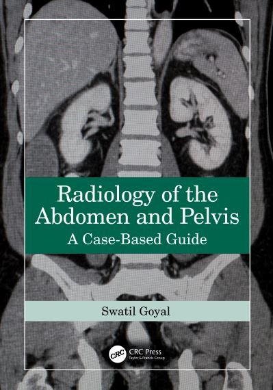 Cover for Goyal, Swati (Gandhi Medical College, Bhopal, India) · Radiology of the Abdomen and Pelvis: A Case-Based Guide (Paperback Book) (2024)