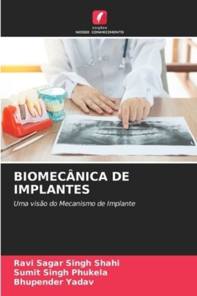Cover for Ravi Sagar Singh Shahi · Biomecanica de Implantes (Paperback Book) (2021)