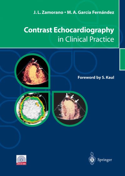 Contrast Echocardiography in Clinical Practice - Jose L. Zamorano - Books - Springer Verlag - 9788847021747 - October 3, 2013
